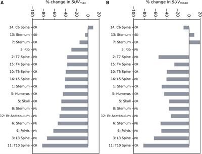 [18F]NaF PET/CT imaging of response to single fraction SABR to bone metastases from breast cancer